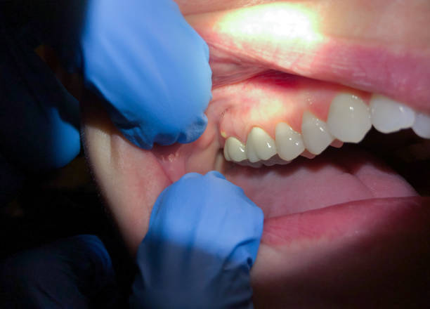 Best Mobile Emergency Dentist in Taylors, SC