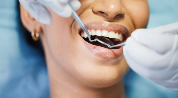 Best Pediatric Emergency Dentist in Taylors, SC