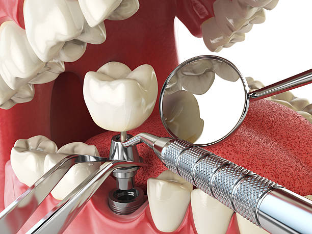 Best Emergency Dental Services for Seniors in Taylors, SC